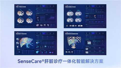 商湯醫(yī)療獲肝臟CT輔助診斷NMPA三類(lèi)證，軟硬件零售賦能肝臟診療一體化新格局